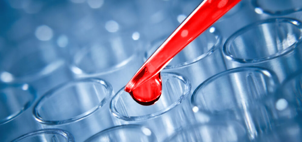 Legionella-risk2